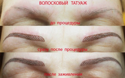 Hair tetoválás szemöldök véleménye, technológia, sokkal tart fotók (haj tetoválás szemöldök) Hair tetoválás szemöldök visszajelzést technológia, mint tart, fotók