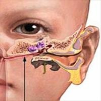 Запалення вуха симптоми, причини і лікування у дорослих і дітей