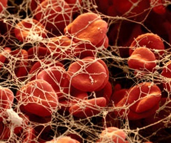 Miért vérátömlesztésre egy véna a farba (autoterapiya)