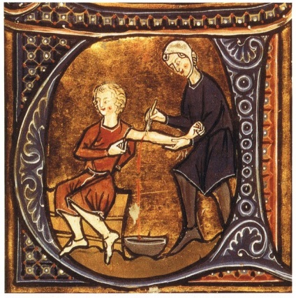 Szörnyű kezelt, mint a gyógyszert a középkorban - férfi portál mport