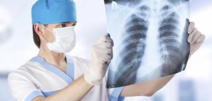 A járóbeteg-tuberkulózis kezelésére mítosz vagy valóság?
