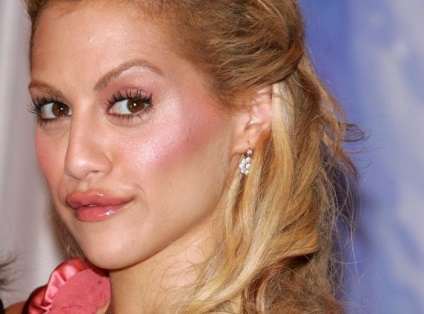 A botulinum -, hogy az anti-aging arckezelés (anti-aging) A botulinum -, hogy az anti-aging arckezelés