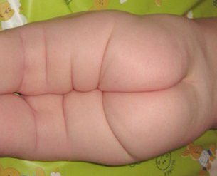 A fogantyú redői egy újszülött (szeres) A fogantyú összecsukható újszülött