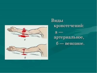 Mi különbözteti meg az artériás vénás vérzés