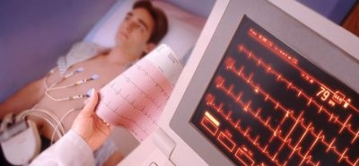 Cubendokardialnaya ischaemia jelei az EKG (iszkémia) Cubendokardialnaya ischaemia jelei az EKG