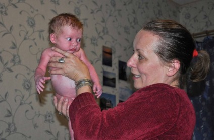 Bénulás csecsemők a jelek és tünetek a gyermekek legfeljebb 1 éves megnyilvánuló
