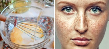 Otthoni wellness az arcbőrnek: a legjobb arcpakolások