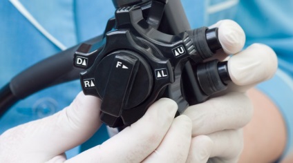 Az endoszkópos ultrahang innováció