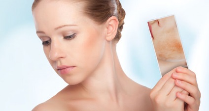 Hyperkeratosisát bőr okok és a kezelés