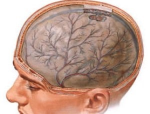 agyi stroke és annak hatása a gyógyulási esélyei