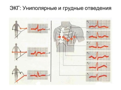 Milyen gyakran lehet csinálni EKG szív