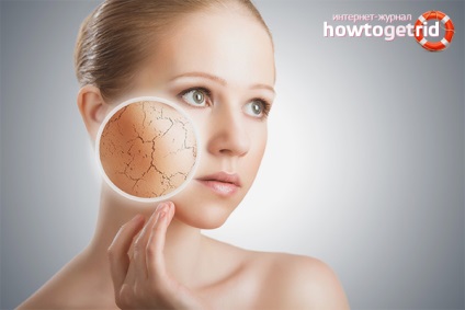 Hogyan lehet megszabadulni a száraz bőr az arcon otthon