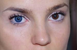 Hogyan változtassuk meg a szem színes kontaktlencse típusú dekorációs lencsék a szem színének megváltoztatására, mint