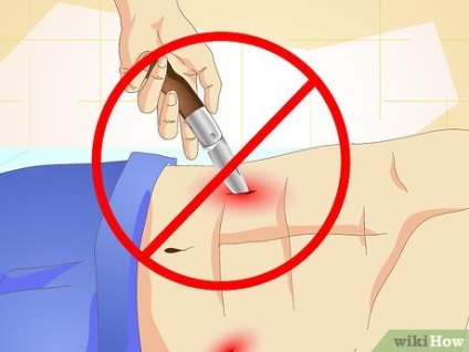 Hogyan kell kezelni a kés sebet