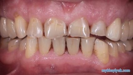 Hogyan válasszuk ki a jó fogorvos