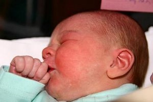 Mi az allergia csecsemők okoz az, allergiák kezelésére csecsemők