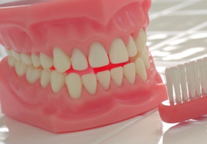 Hogyan erősít a fogsor