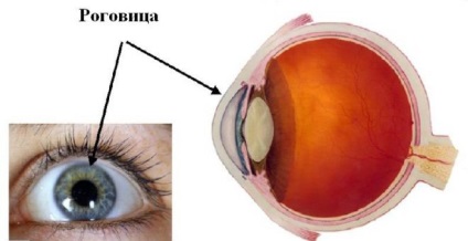 Candidiasis szem (gomba) tünetei és elváltozások kezelésére