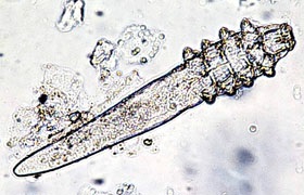 Skin paraziták a kutyák - Rossz bőrben az kínai meztelen - rüh a kutyák - demodikózis kutyák (demodicosis) Skin paraziták a kutyák - Rossz bőrben az kínai meztelen - rüh a kutyák - demodectic rüh a kutyák,