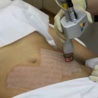 Vörös kaviár szoptatós anyáknak (kár, hogy a vörös kaviár) Vörös kaviár szoptatós anyáknak
