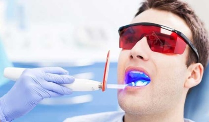Gum lézeres kezelés - egy innovatív módszer és ellenjavallatok