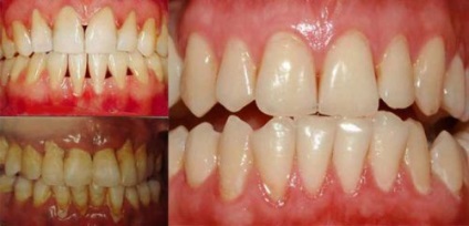 Parodontológia | Liget Fogászati Rendelő Szeged | Esztétikai fogászat, Fogszabályozás