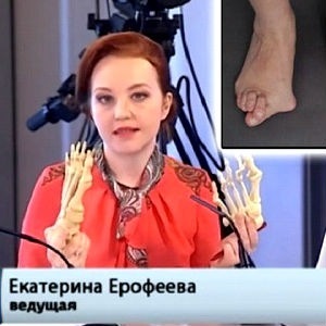 A kezelés a kúpok a lábánál, közel a nagy lábujj