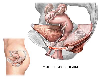 Levatoroplastika - urogynecology - svájci klinikán Moszkvában