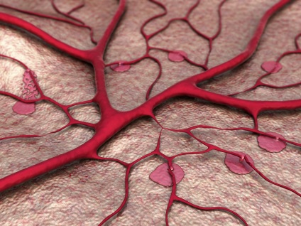 alsó végtagok lymphorrhea kezelésére és okok (rövid szénláncú) alsó végtagok lymphorrhea kezelést és okai