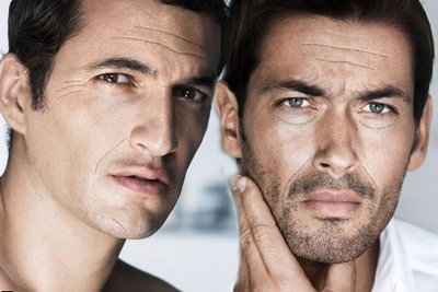 Ráncok az arcon férfiak - hogyan lehet csökkenteni a láthatóságot, bezmorshchin