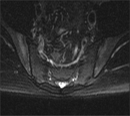 MRI a sacroiliacális közös, Dikulja Központ