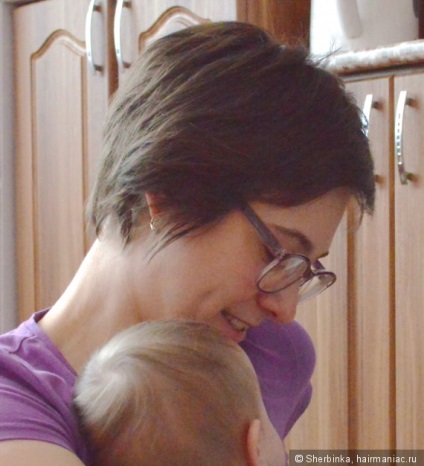 Alopecia areata - szörnyű dolog egy lány! Tudtam, hogy megoldja ezt a problémát az ő részét (alopecia) Alopecia areata - szörnyű dolog egy lány! Tudtam, hogy megoldja ezt a problémát az ő részét