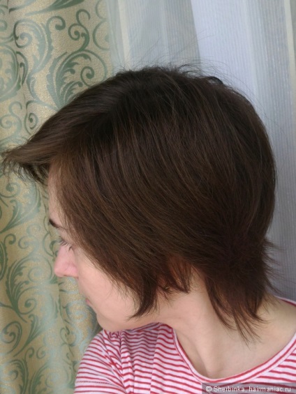 Alopecia areata - szörnyű dolog egy lány! Tudtam, hogy legyőzze ezt a problémát fogom megosztani a (sikertelen) Alopecia areata - szörnyű dolog egy lány! Tudtam, hogy megoldja ezt a problémát az ő részét