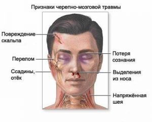 Törés a koponyaboltozat okoz, tünetek és a kezelés