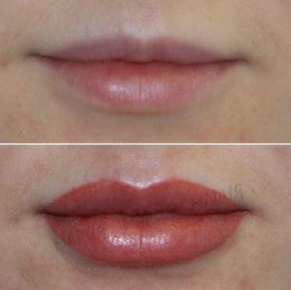 Permanent make-up kép ajkak előtt és után hatások (állandó) Tartós smink ajkak fotók előtt és után hatások