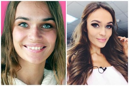 A plasztikai sebészet Alena farmacia, fotók előtt és után plasztikai