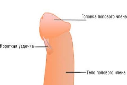 Műanyag frenulum fityma ár és vélemények eredményei