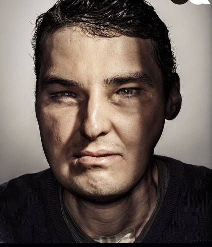 Miért vagyok olyan csúnya „4 csoda Plasztikai Sebészek (a képen) (Plastic) Miért vagyok olyan csúnya „4 csoda Plasztikai Sebészek (fotó)