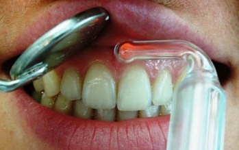Alkalmazása modern fizioterápiás technikák a fogászatban