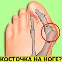 Megelőzés A prosztatagyulladás a férfiak gyógyszer, népi jogorvoslat, edzés (megelőzés) Megelőzés A prosztatagyulladás a férfiak gyógyszer, népi jogorvoslat, gyakorlatok
