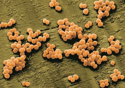 A szerepe a mikroorganizmusok a fertőzés folyamatát az alapfogalmak