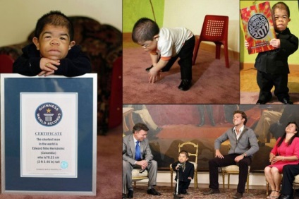 A legfiatalabb ember a világon, és a legkisebb ember a világon (8 fénykép)