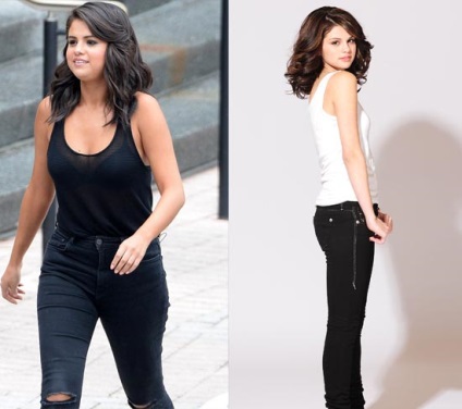 Selena Gomez anorexiás lett?
