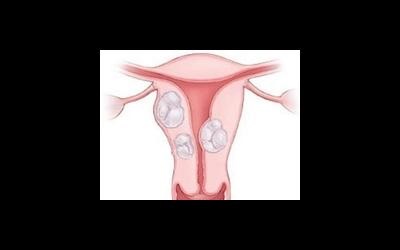 milgamma hatása a menstruációra diabetes symptoms type 2 nhs
