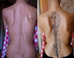 A tetoválás olyan módon, hogy álcázzák a heg - rossz madár tinta