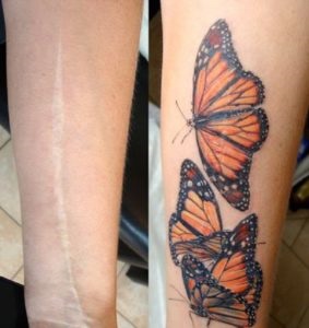 A tetoválás olyan módon, hogy álcázzák a heg - rossz madár tinta