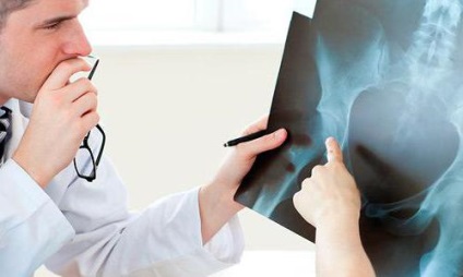 A csípőízület, különösen a röntgen, az előnyök és hátrányok