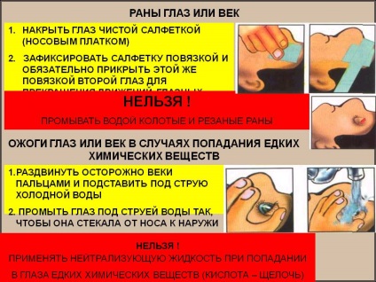 Szemsérülés, kezeléséből szemészeti trauma (idegen szemek) Szemsérülés, annak kezelése, szem trauma