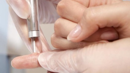 Tetoválás eltávolítása kulcsfontosságú kérdések és válaszok (törlés) Tetoválás eltávolítás fő kérdések és válaszok