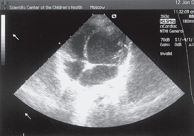 Thymus mi miért felelős, ahol a hormonok és a funkció (válasz) Thymus mi miért felelős, ahol a hormonok és a funkció